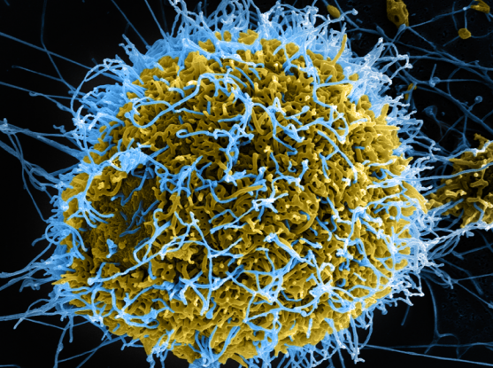 An image of ebola virus particles as seen from a microscope.