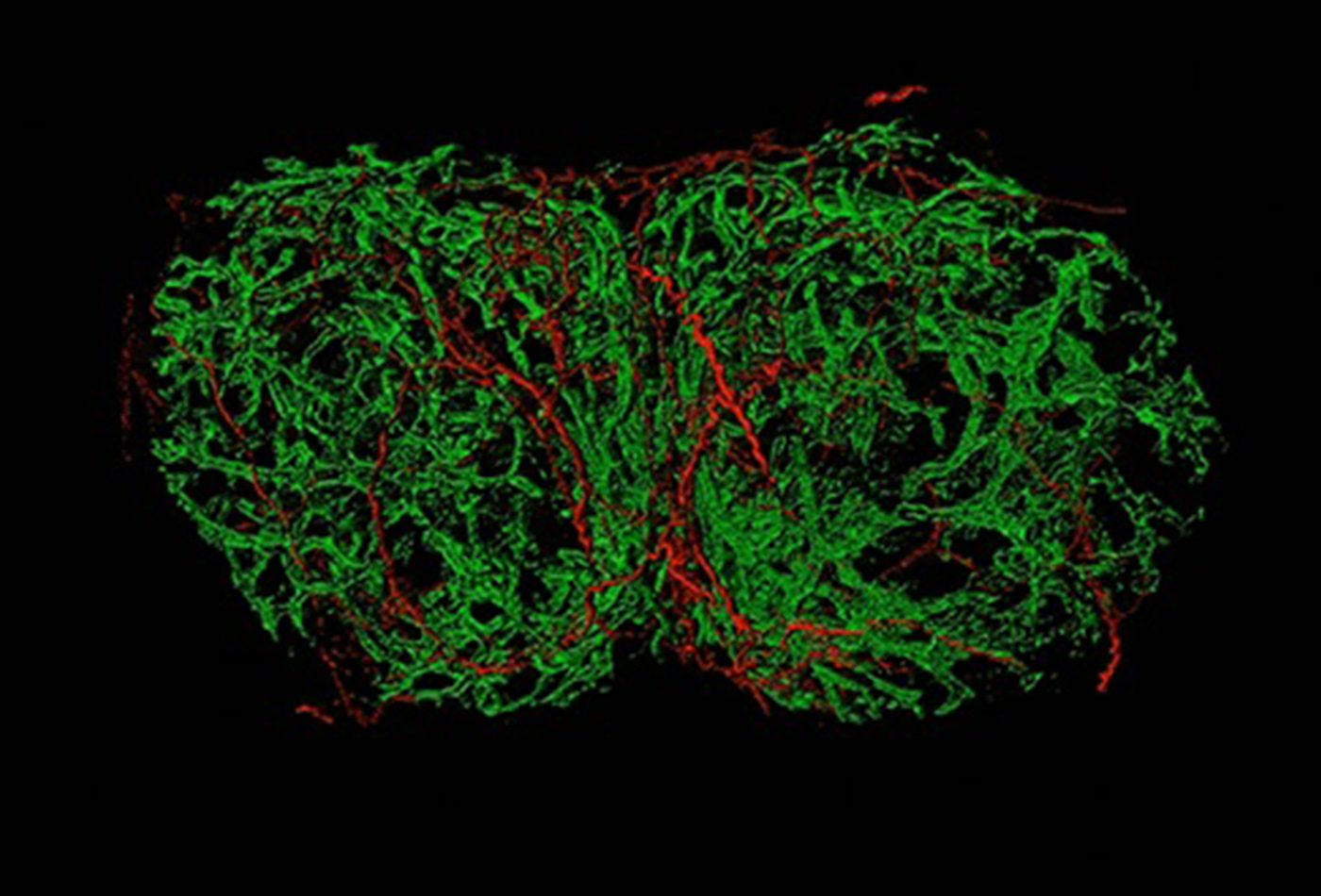 A red and green diagram depicting sensory nerve fibers interacting with lymph nodes.
