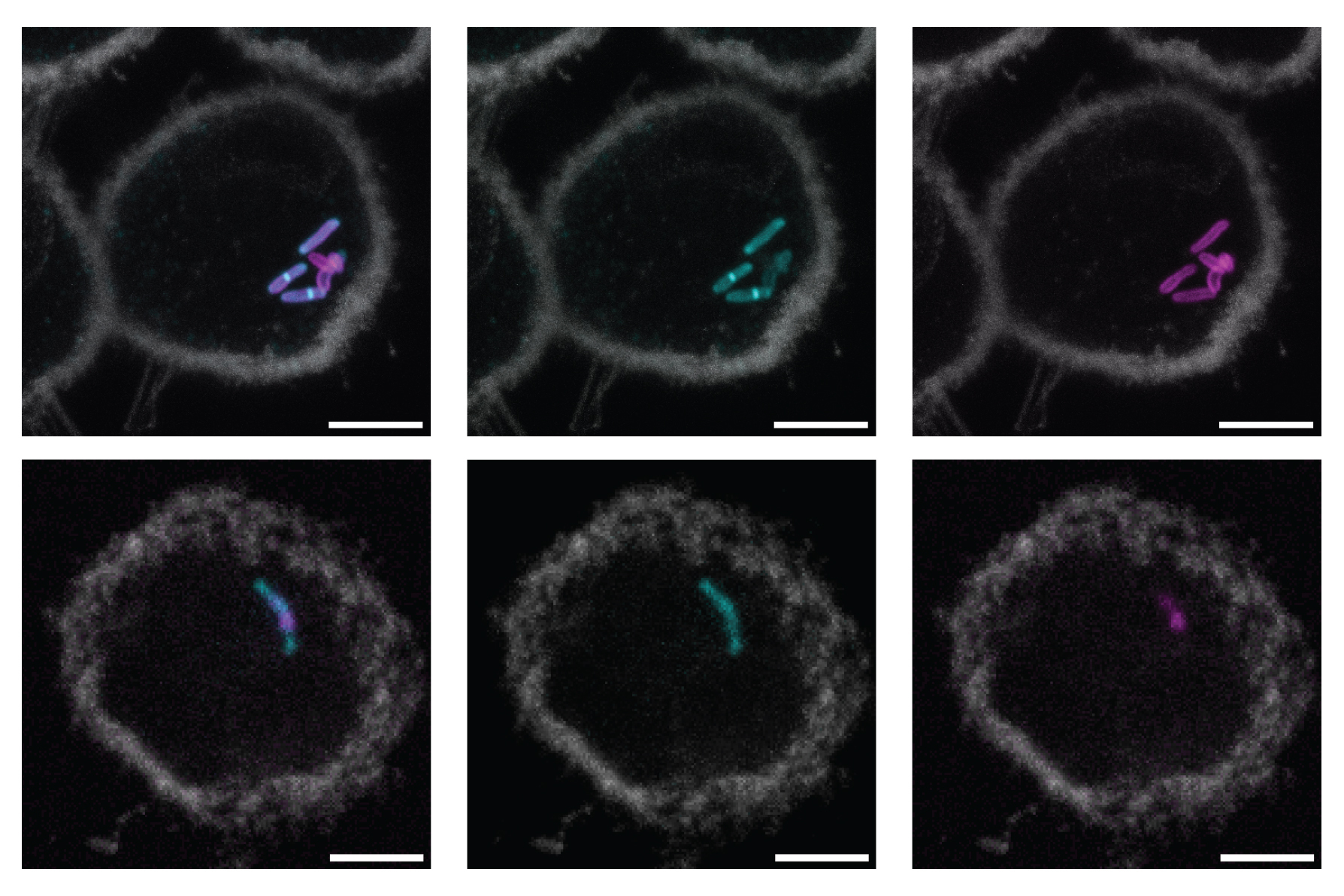 Image of macrophages infected with mycobacterium tuberculosis.