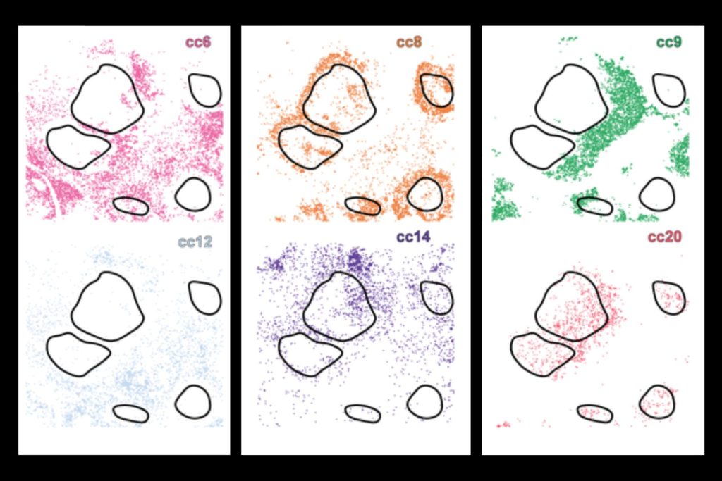 New AI system uncovers hidden cell subtypes, boosts precision medicine ...